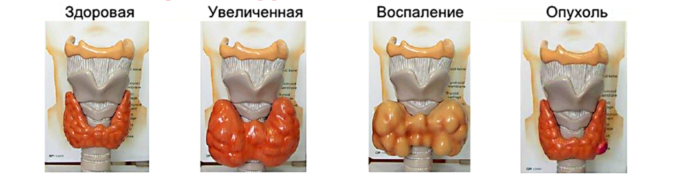 УЗи щитовидки, узи щитовидной железы в Москве